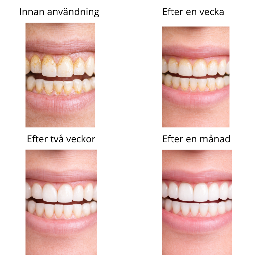 TandGlans™| Djup rengöring hemma