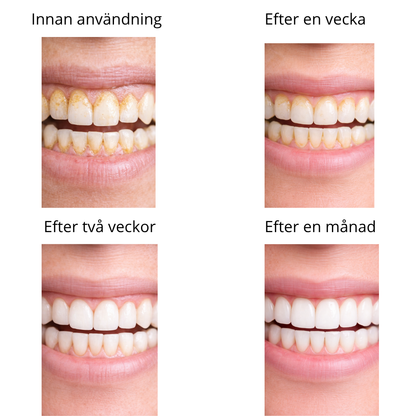 TandGlans™| Djup rengöring hemma