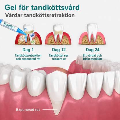 TandRo™ | Precisionsgel för daglig tandköttsvård – på bara 14 dagar!