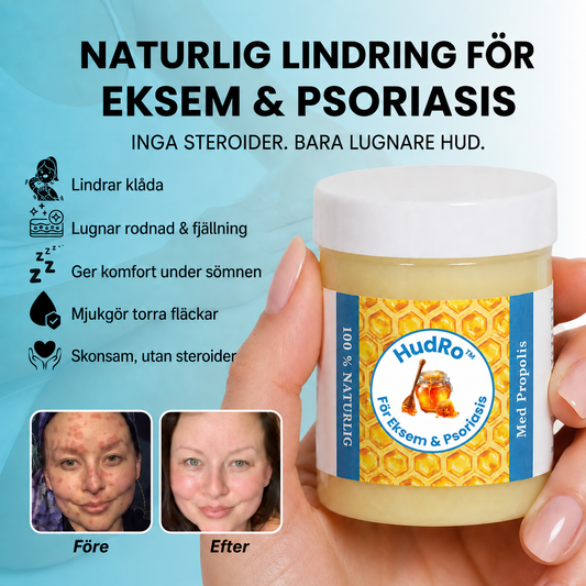 HudRo™ | Stoppa klåda från eksem & psoriasis och lugna irriterad hud. Synlig effekt på 14 dagar!