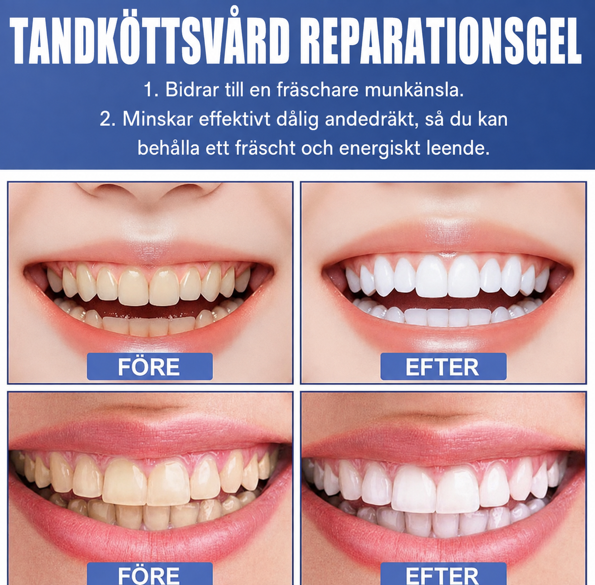 TandRo™ | Precisionsgel för daglig tandköttsvård – på bara 14 dagar!
