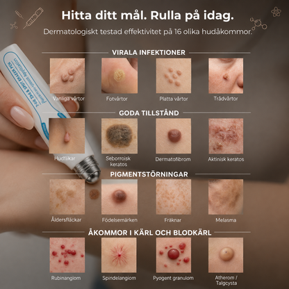 HudRen™ | Roll-on för hudflikar och vårtor
